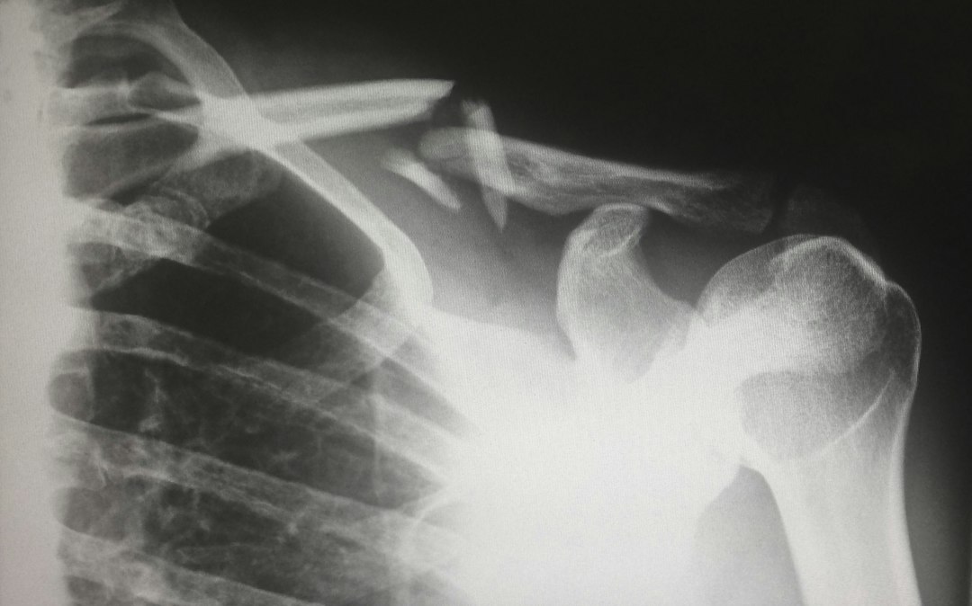 human X-ray result chart
	Author: Harlie Raethel
	